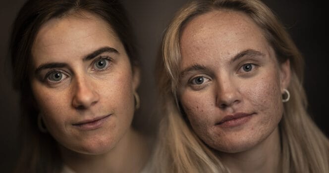 Linn Svahn och Ebba Andersson säger vad de tycker om ryska skidåkare.