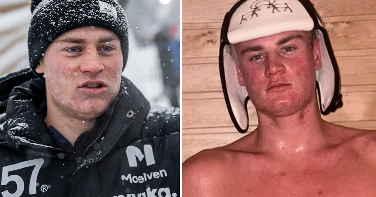 Alvar Myhlback väcker reaktioner med ny bild.